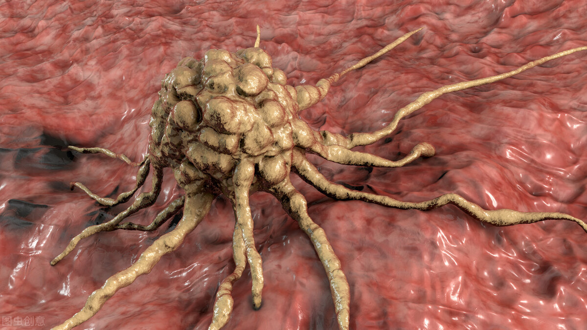 囊肿很多年不处理会有危害吗,有的囊肿一辈子不长吗