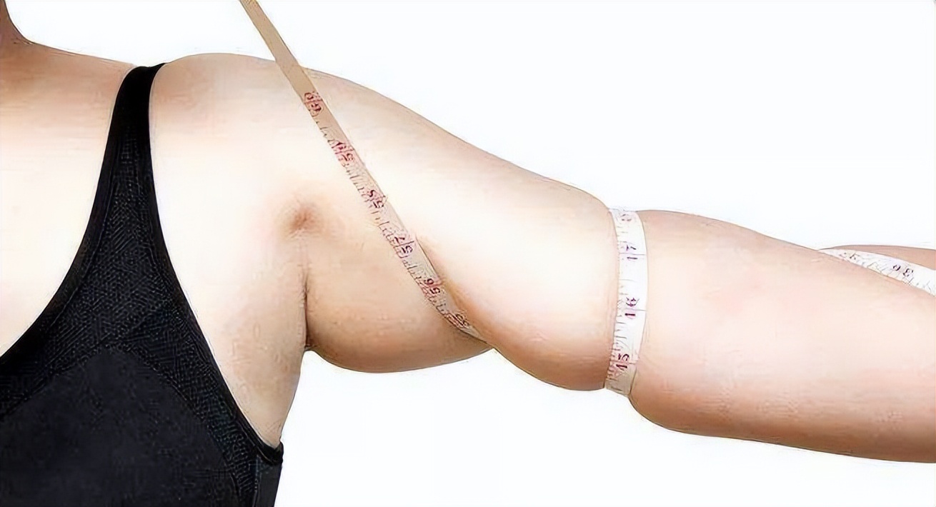 肚子大腿脂肪多怎么办,肚子大腿胖怎么减下去