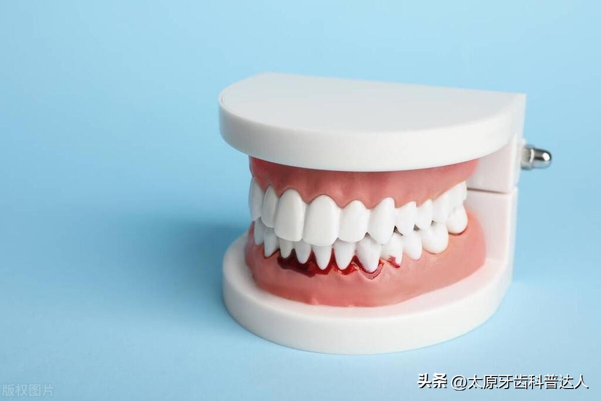 牙龈出血牙齿松动的原因是什么,牙齿松动牙缝越来越大是什么原因