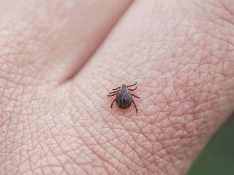 仓鼠咬人全身皮肤变成火龙果事件,杭州一女子买仓鼠得恙虫病