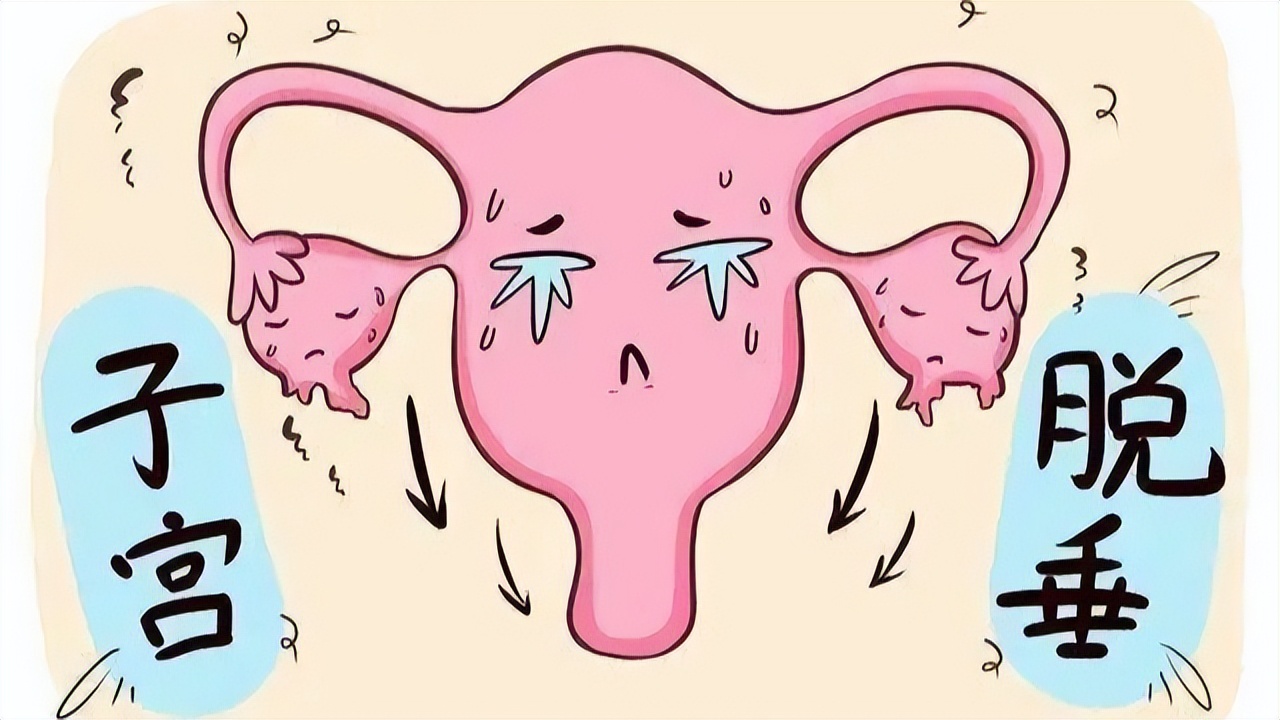 女性六十岁子宫脱垂怎么治疗,子宫脱垂一级的女性多吗