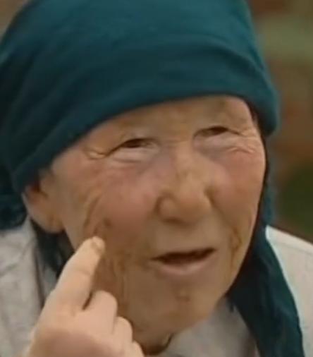 故事:江苏70岁老人头疼欲裂,检查时发现颅内有*弹子**,吓坏在场医生