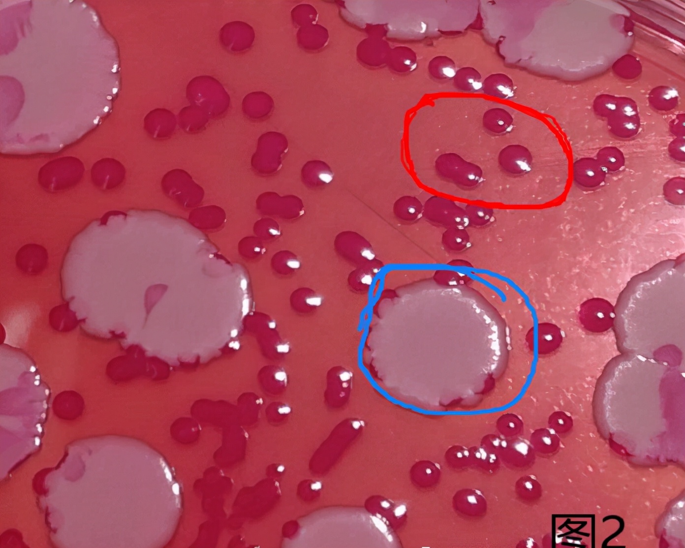 霉菌酵母菌检测方法视频,霉菌检验方法步骤
