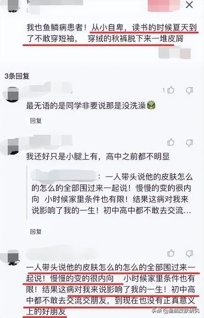 夏季皮肤干燥起皮鱼鳞病,冬季鱼鳞病怎么才能改善