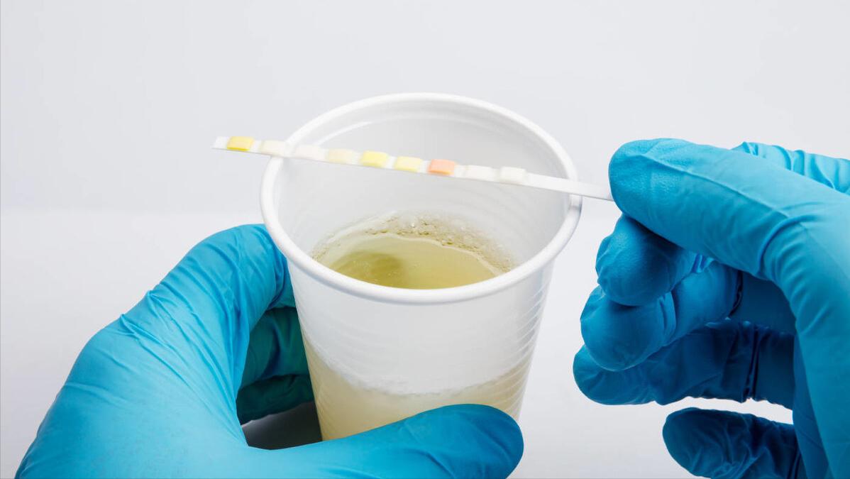 降糖效果好的药达格列净,降糖新药达格列净的效果