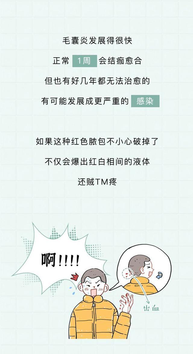 头皮上白色的小颗粒可以抠下来,为什么抓头皮会有白色小颗粒