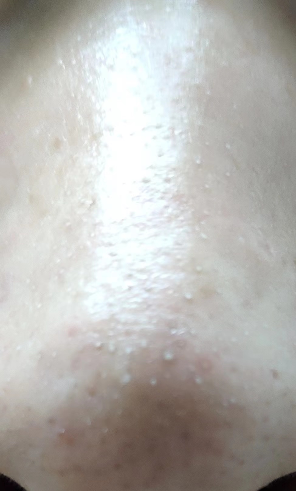 涂完粉底液鼻子上有白点,上完粉底液之后为什么鼻子有白点