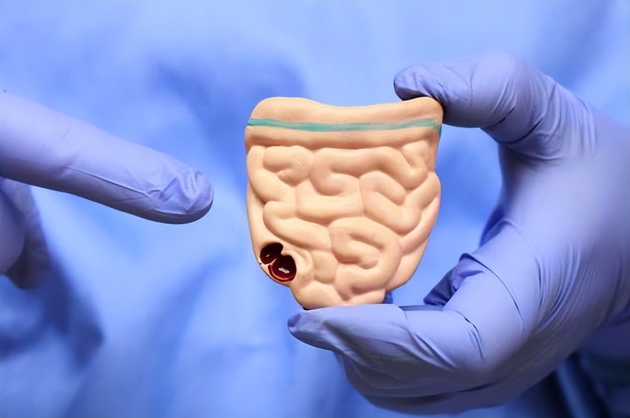 胆囊息肉切除后遗症怎样才能恢复,胆管结石胆囊结石切除有后遗症吗