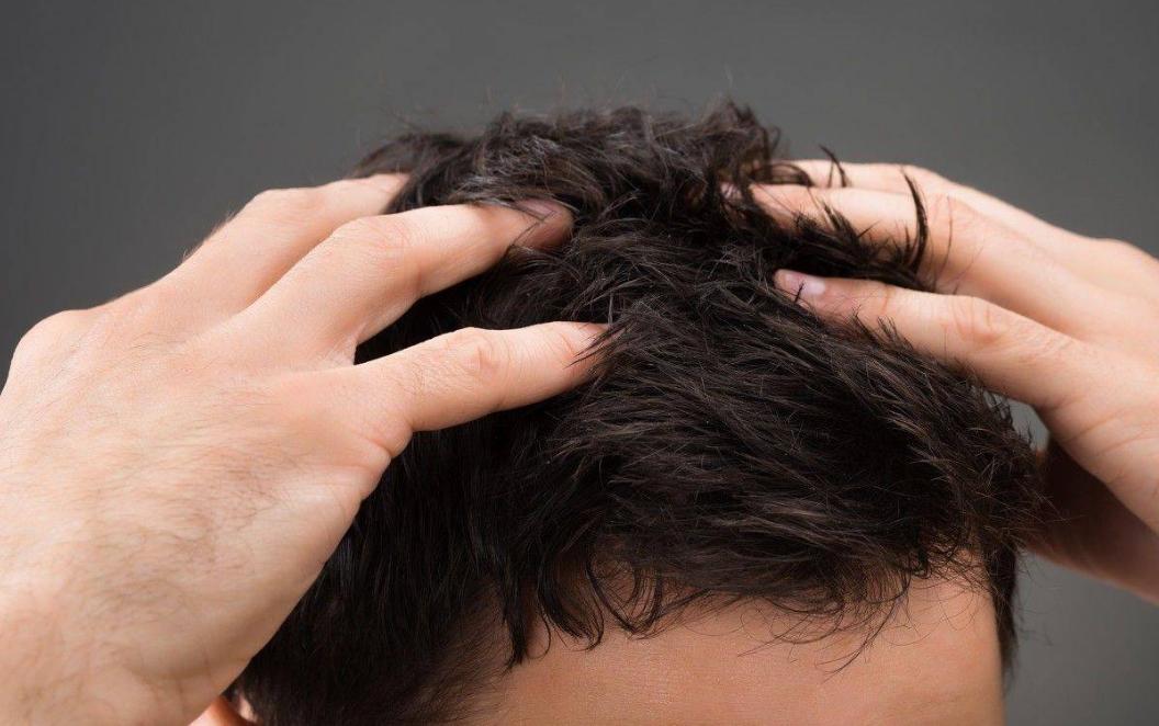 头皮总是长疙瘩或脓包是什么原因,头皮反复长疖肿起脓包