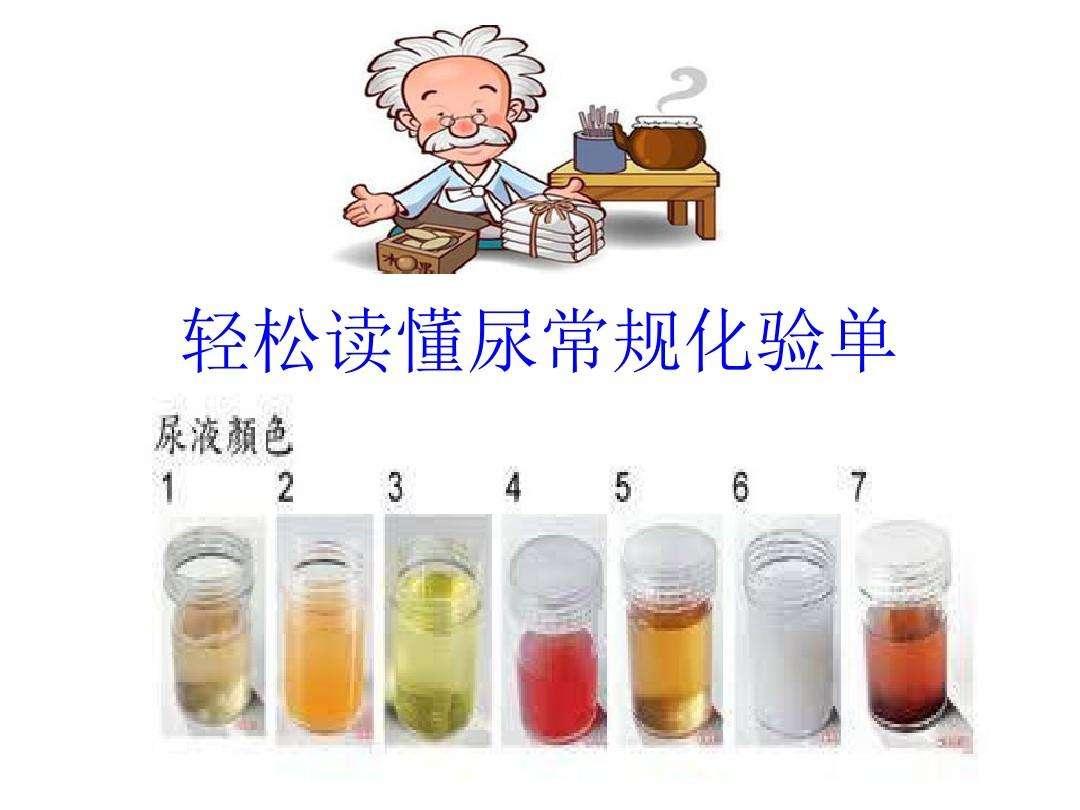 尿潜血试验阳性尿白细胞阳性,尿潜血试验阳性吃什么药治疗