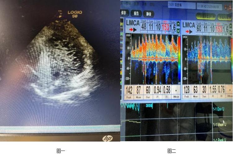 一打喷嚏头疼眼胀,打喷嚏就头疼是什么原因