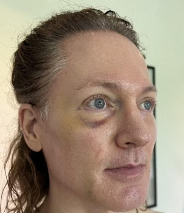 45岁亿万富翁与儿子换血,45岁亿万富豪重回18岁