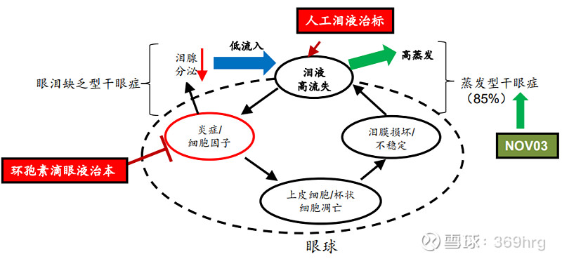 眼科用药的研究报告,眼科深度研究