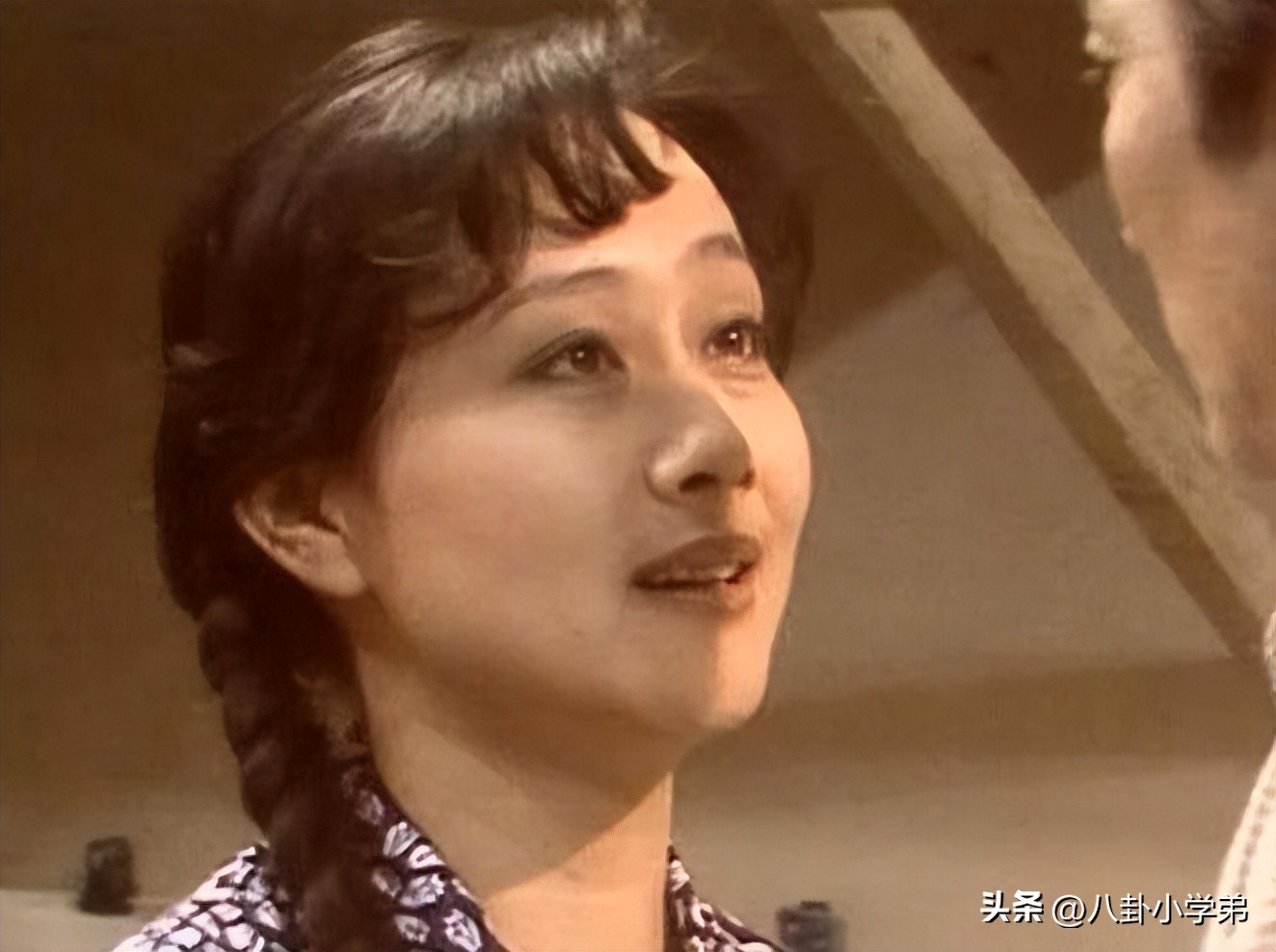 整形脸和真正的美人区别,整形变美的对比图片