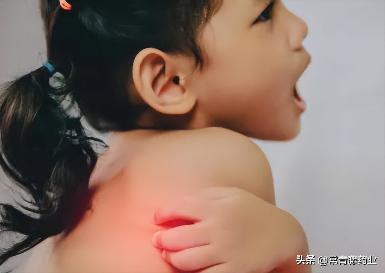 老长痱子怎么就不长痱子了,成年人长痱子怎么办快速解决