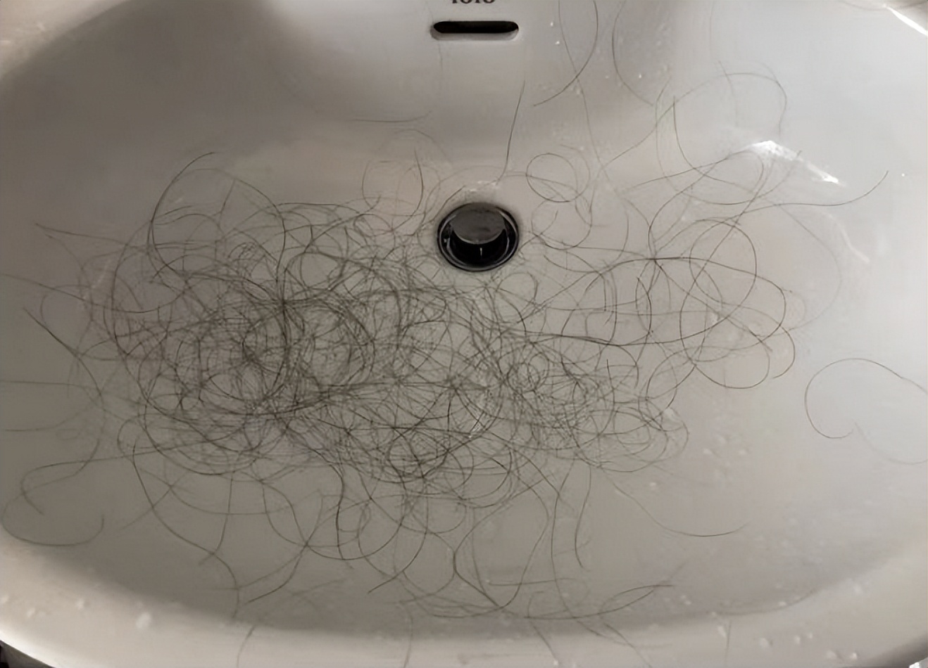 甲减人群痴呆症风险增加81%！三招先自测风险