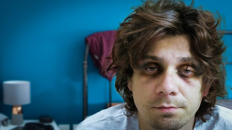 熬夜一时爽一直熬夜身体受不了,熬夜一时爽一直熬夜变秃头