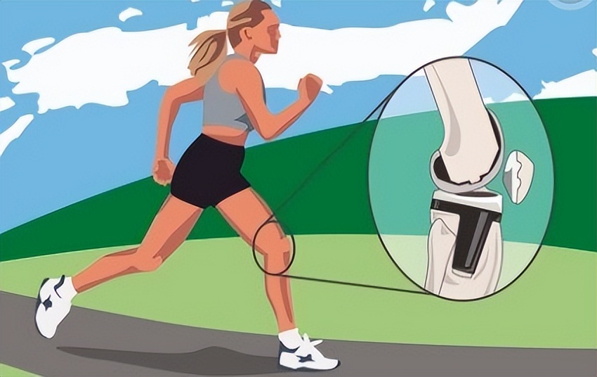 半月板保护用护膝还是髌骨带,半月板是消耗品吗