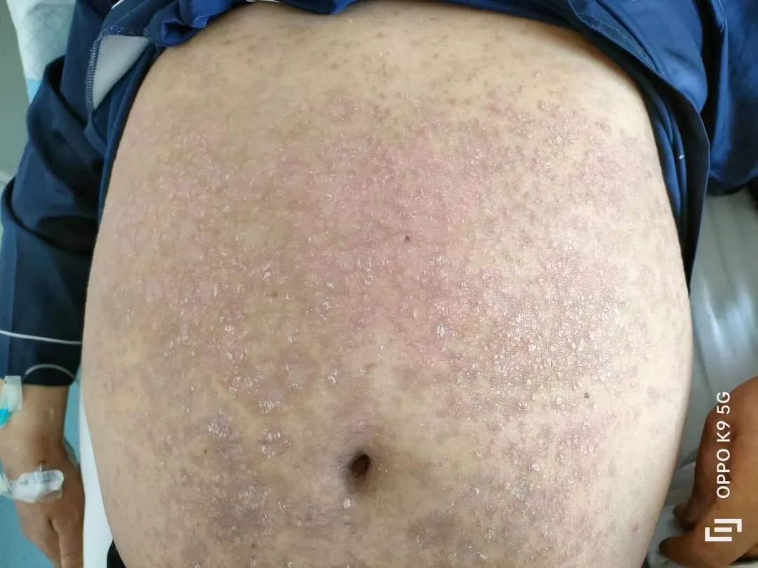 百病从肝治的出处,百病从肝治的中医