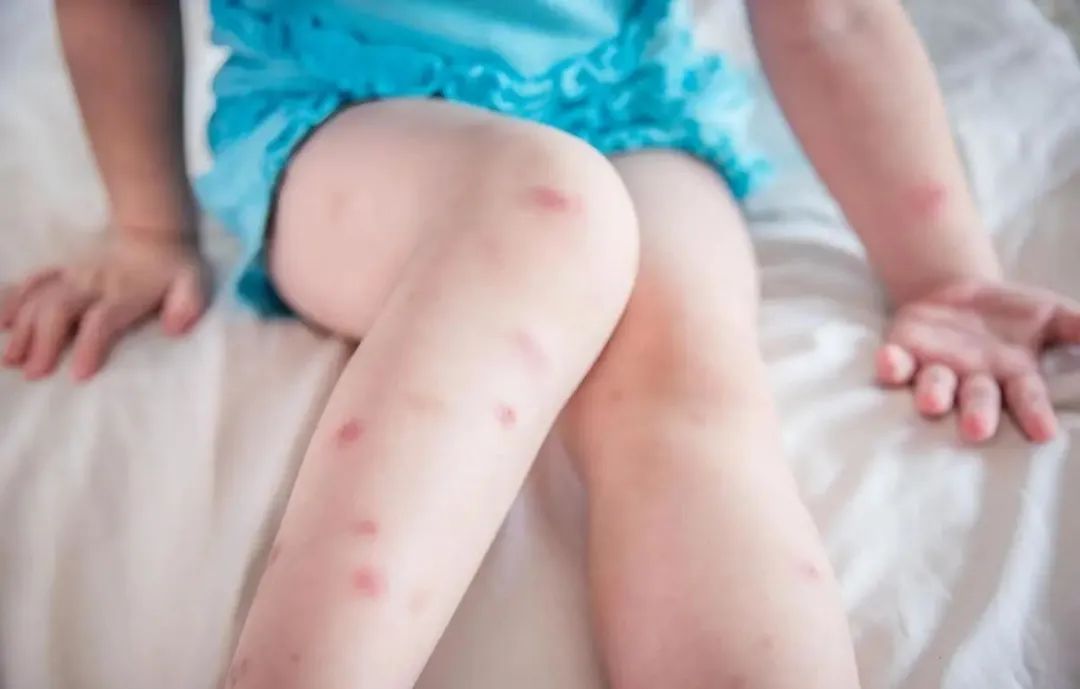 蚊子最怕的不是蚊香而是它,蚊子最大的天敌不是蚊香教你一招