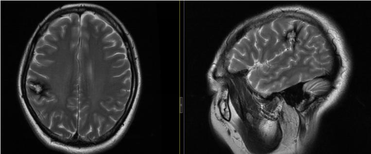 困扰多年实际很好治的病,困扰多年的几个问题