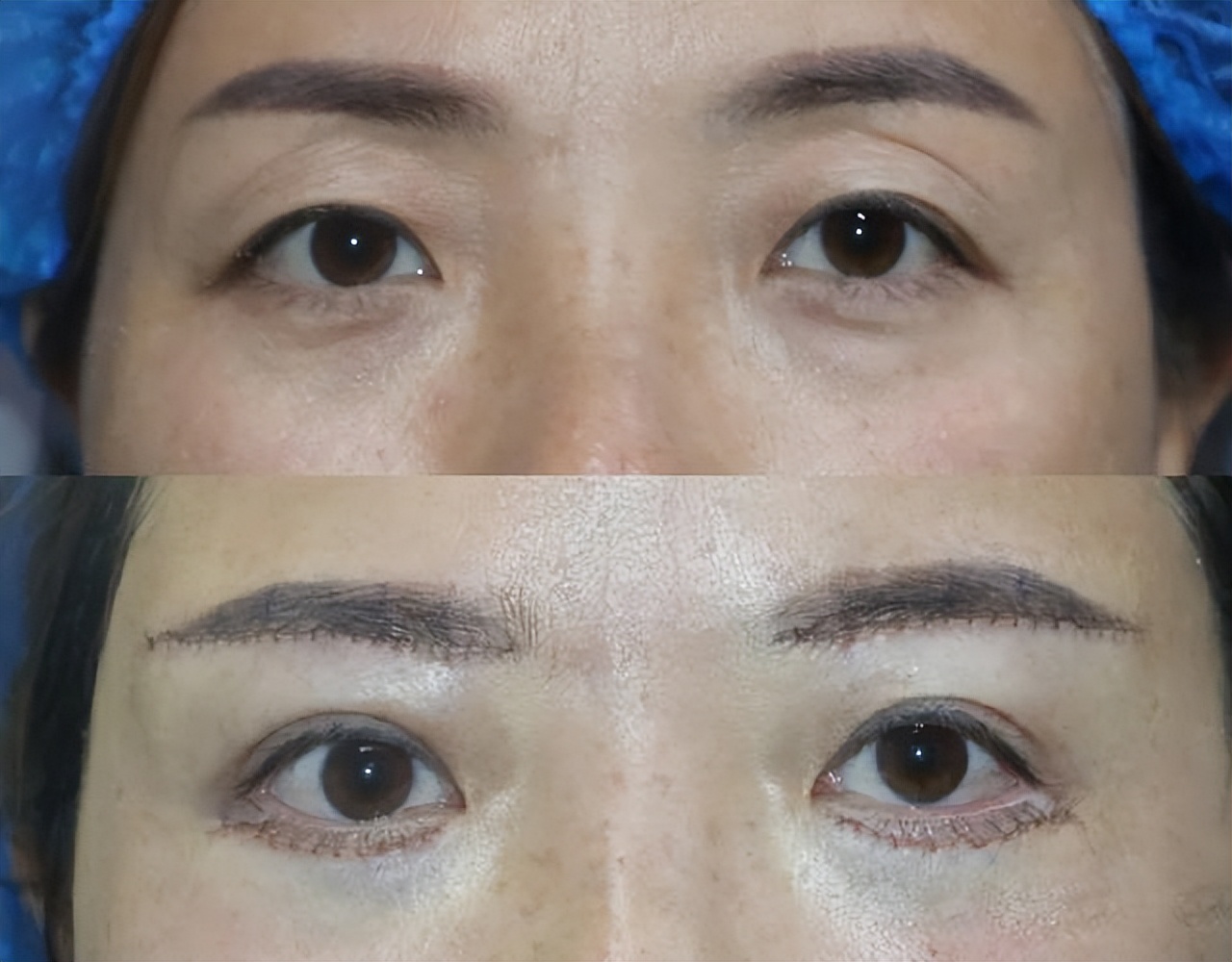 做过提眉有后悔的吗,做过提眉术的眉形设计