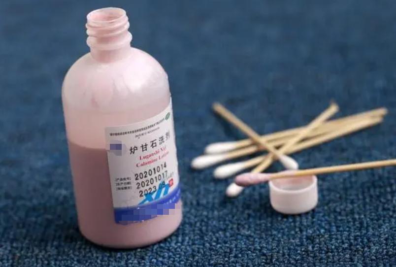 国字号炉甘石洗剂的功效与作用,哪个牌子的炉甘石洗剂效果好