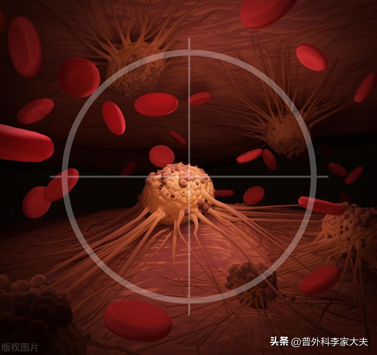 肝癌靶向治疗方法大全,肝癌的靶向治疗