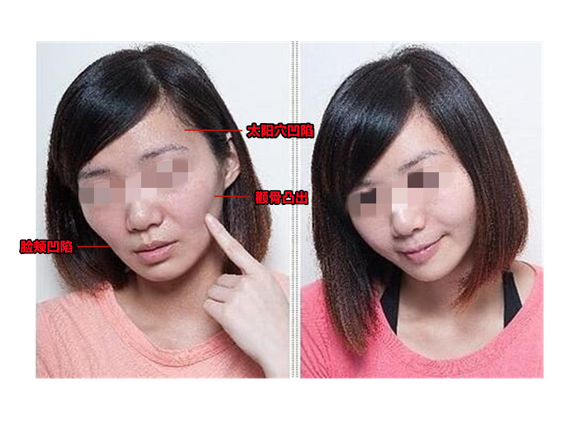 男生整牙会变丑吗,为什么有些人越整越丑呢