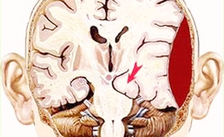 头部摔伤后怎么判断是否严重,摔伤科普视频