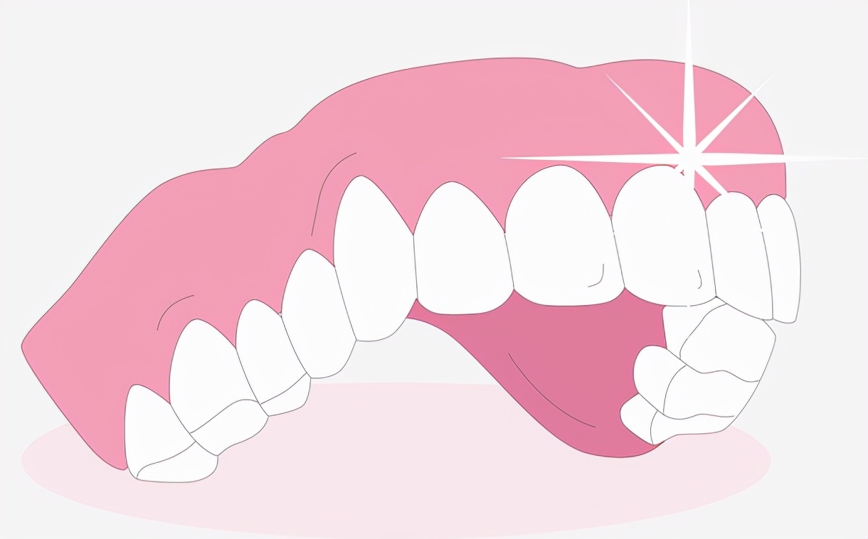 洗牙后牙齿酸软是什么原因,牙齿里的那些事儿