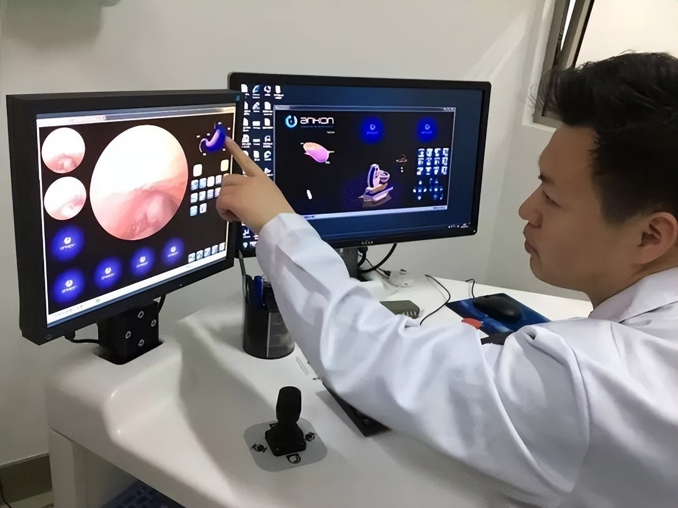 胃镜有必要一年一做吗,胃镜有必要一年一次吗