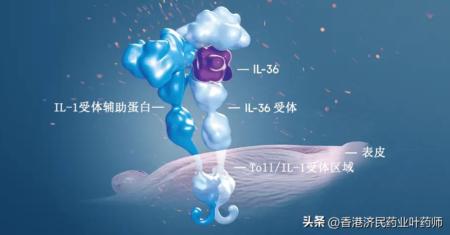 脓疱银屑病国外上市,泛发性脓疱型银屑病新药