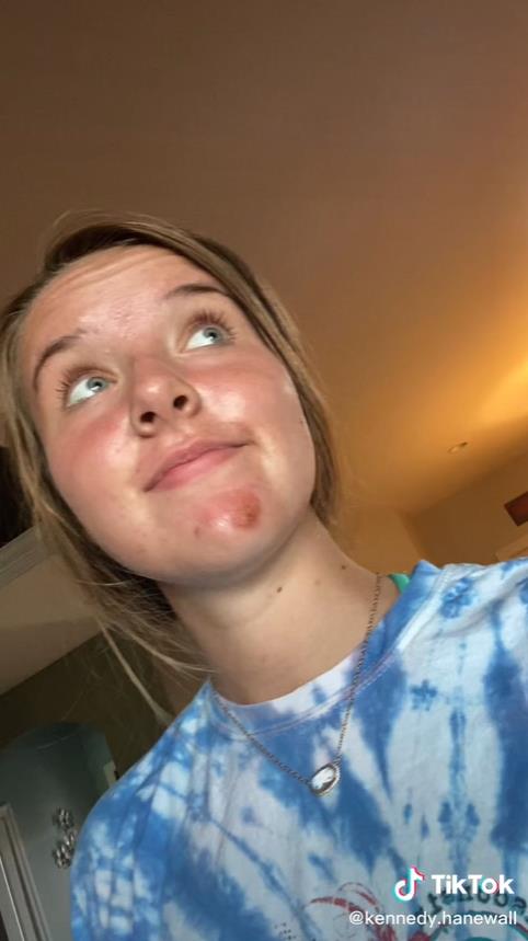 澳洲妹子和男友接吻,澳大利亚女子与男友接吻