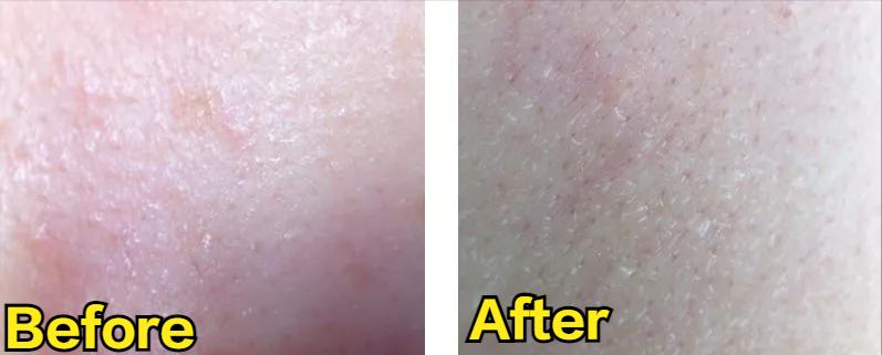 脸泛红是洗面奶的原因吗,为什么用完洗面奶脸会变白