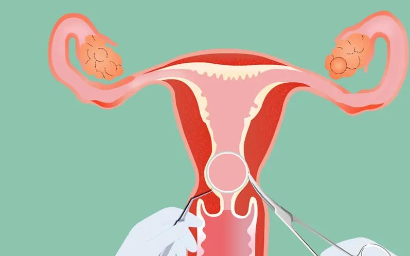 重庆中医院取环费用,安医大第二附属医院取环