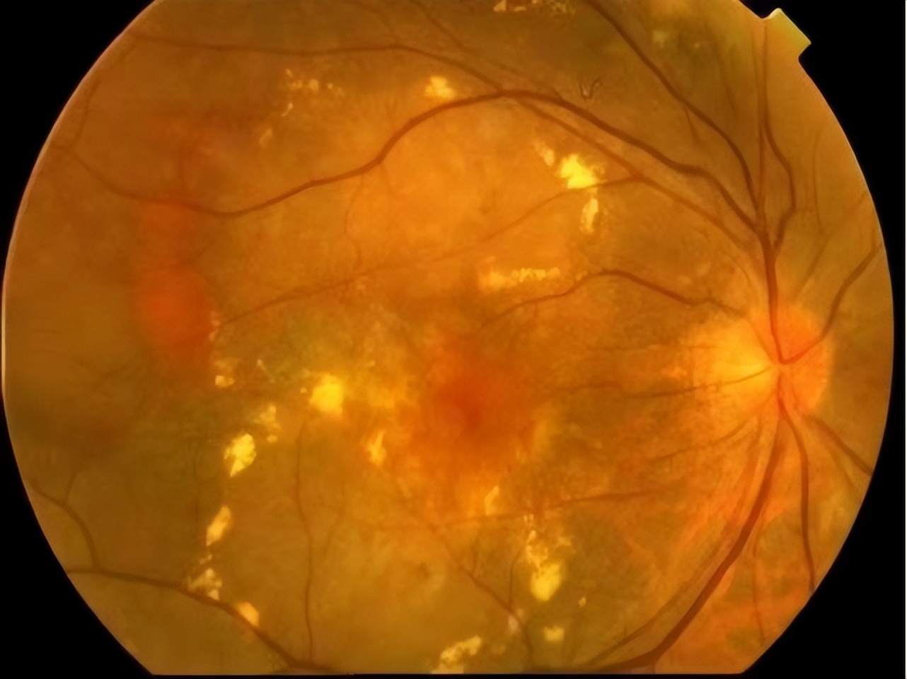 李筱荣教授,天津医科大学眼科医院李筱荣