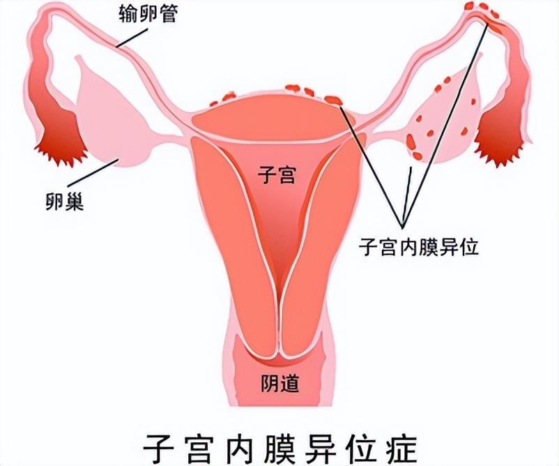 姨妈完后外阴痛怎么回事,姨妈过后外阴有点疼怎么回事