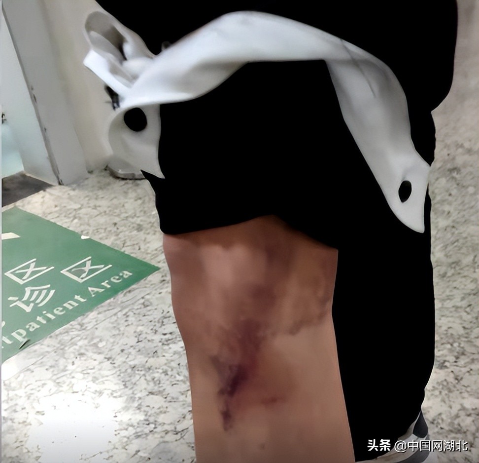 校园霸凌抽皮带,学生被霸凌三年校方回应