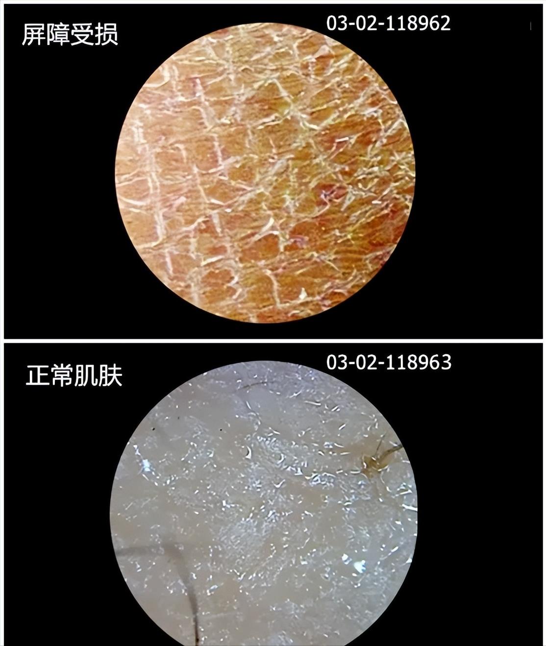 为什么用完洗面奶脸部泛红起皮,为什么用完洗面奶后脸更黑了