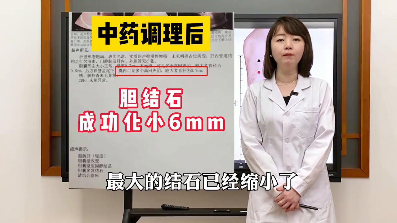 胆结石最快解决方法小妙招,胆结石怎么锻炼才能排出结石