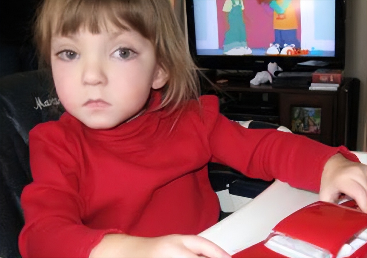 关注罕见病的视频,歌舞伎综合征是什么意思