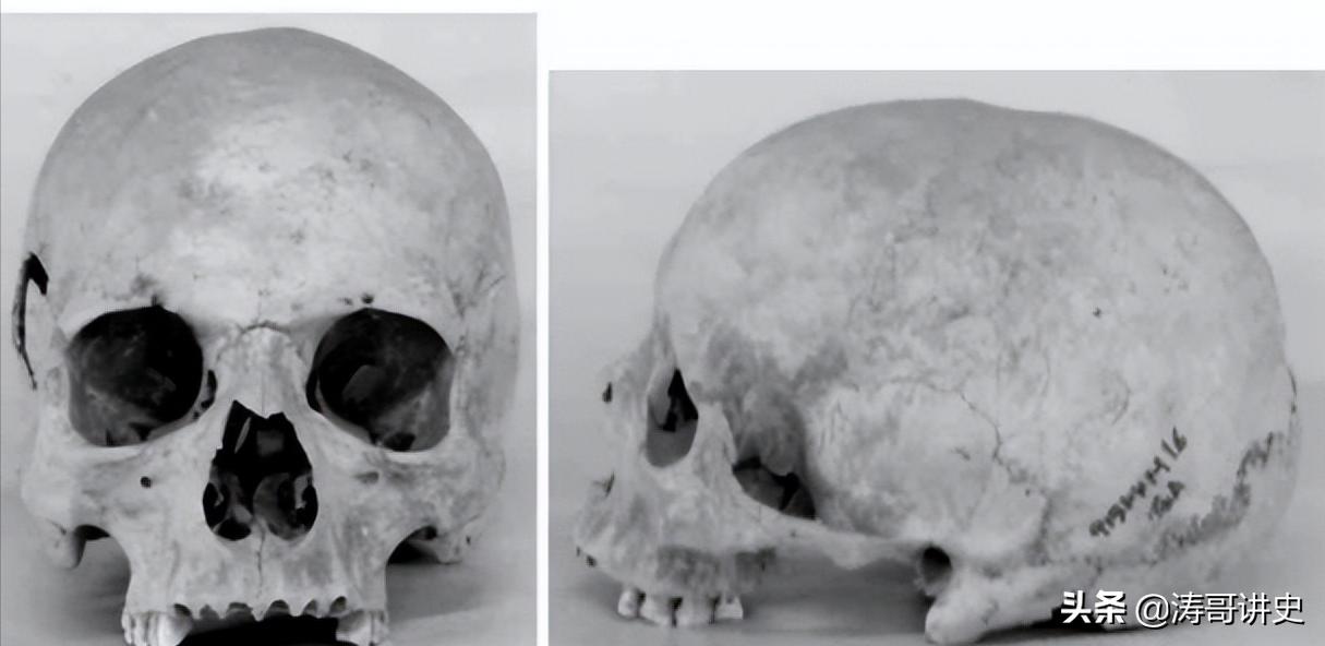 殷墟发现白人遗骨,殷墟遗址出土白人头骨