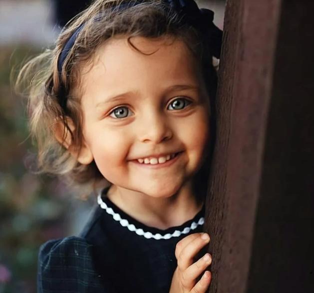 迈克尔杰克逊去世得了什么疾病,迈克杰克逊儿子遗传白化病