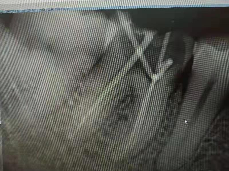 牙疼的厉害怎么办最快止疼牙髓炎,牙疼如果是牙髓炎怎样治