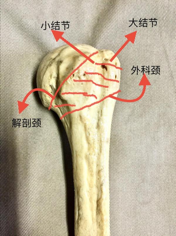 肱骨近端骨折属于几级伤残,肱骨近端骨折康复训练技巧
