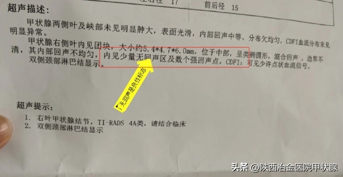 目前消融甲状腺结节手术效果怎样,甲状腺结节消融术后康复效果