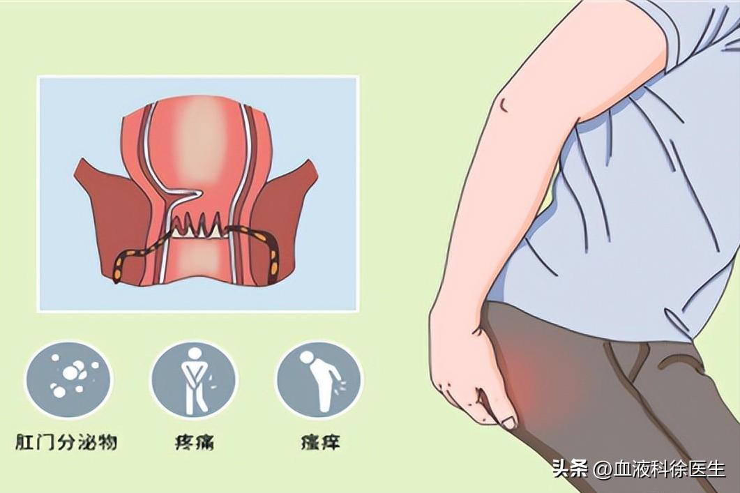 肛瘘手术不彻底医生有责任吗,肛瘘不想手术
