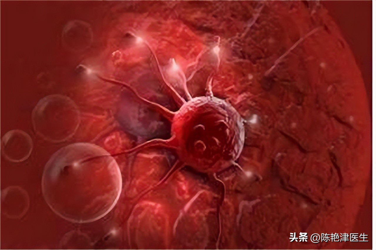 女性为什么容易长子宫肌瘤?提醒:平时尽量避免3个行为,别忽视