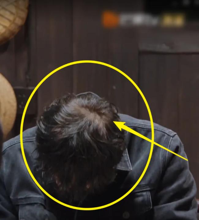 发际线秃的男星,盘点十大秃头男星佩戴假发